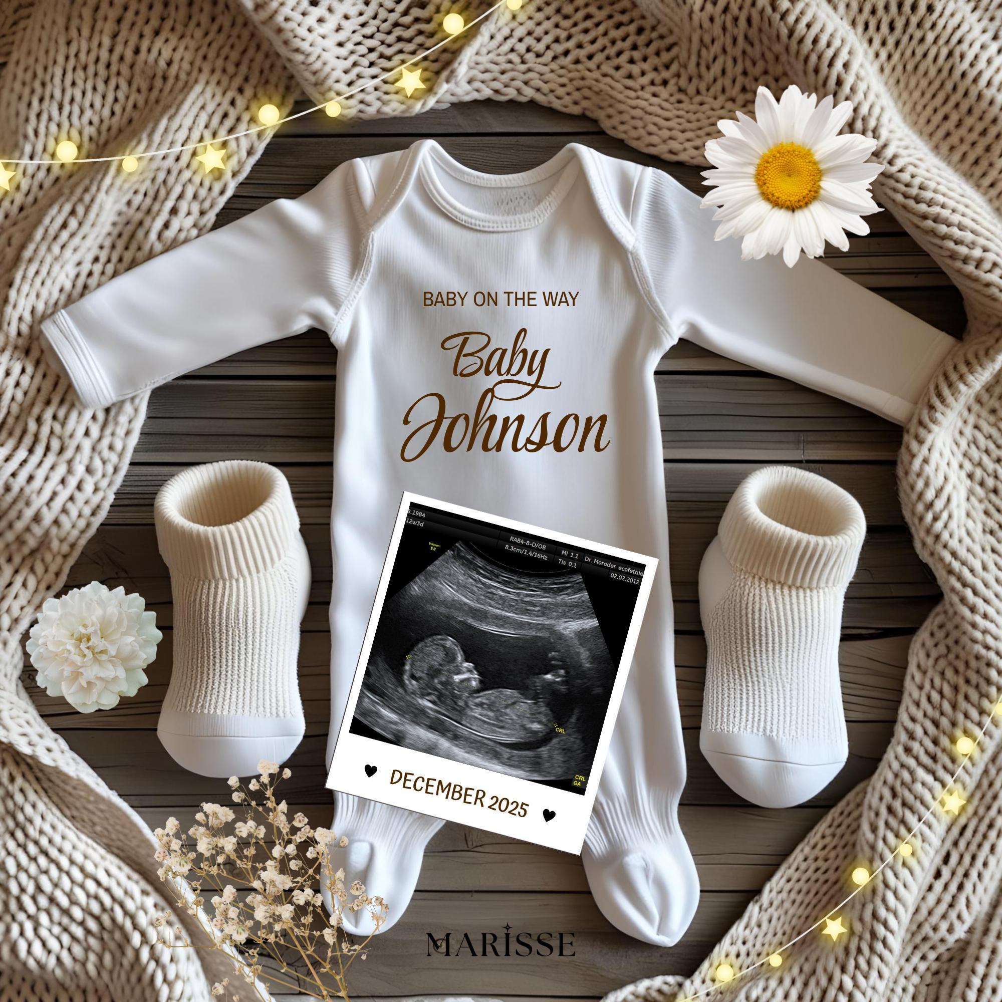Pregnancy Announcement Template Editable Baby Reveal Photo Neutral Ultrasound Birth Announcement Social Media Baby Reveal Instant Download