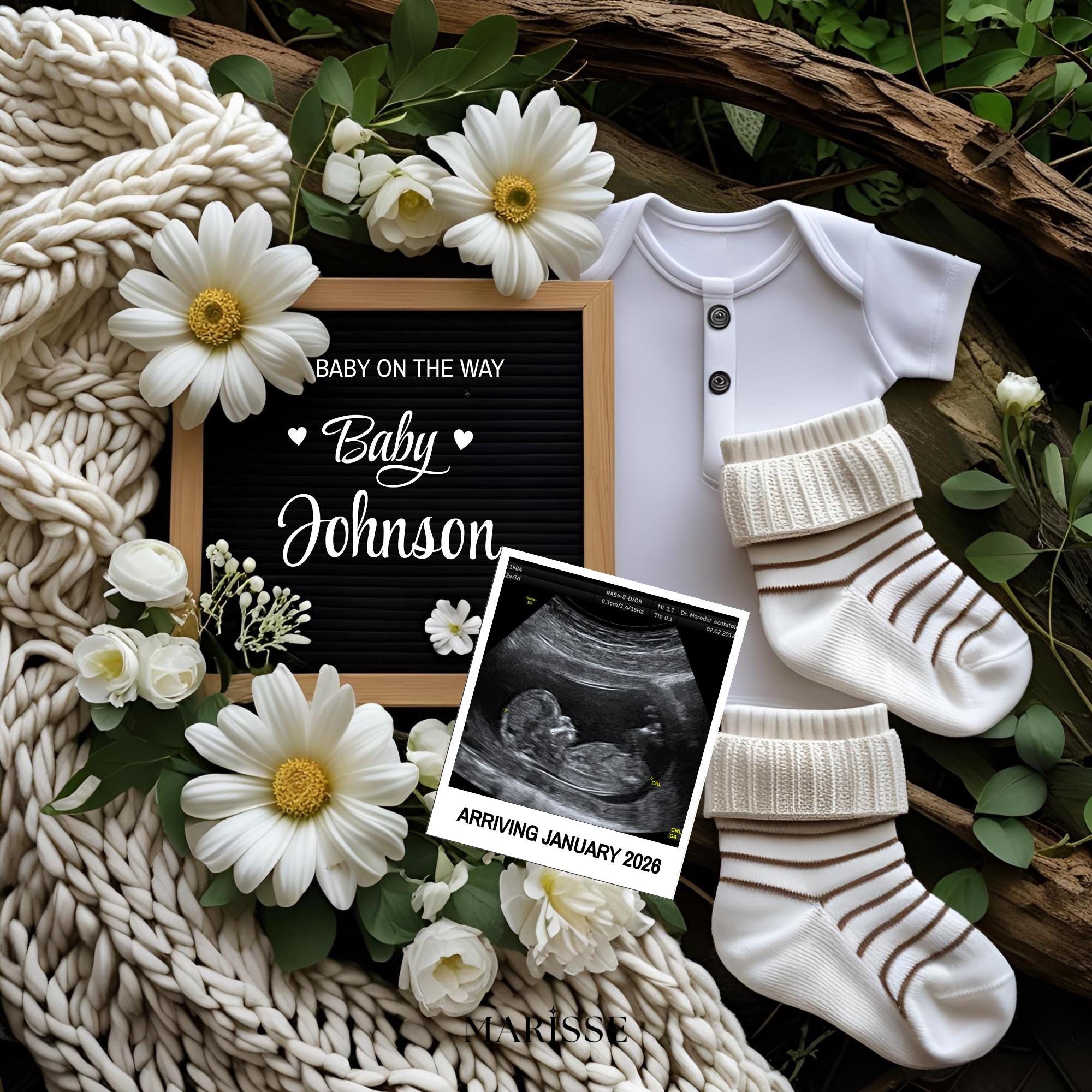 Minimalist Digital Pregnancy Announcement Template | Ultrasound Reveal Template | Editable Baby Announcement Card | Neutral Baby Reveal Sign