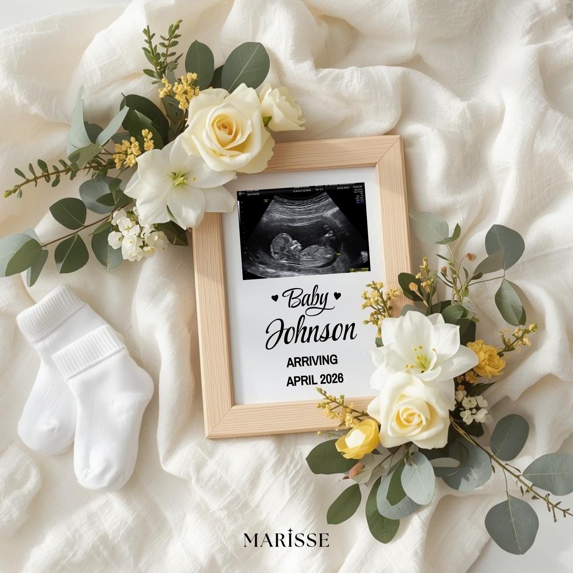 Yellow Floral Pregnancy Announcement Template | Baby Reveal Digital Download | Neutral Ultrasound Photo Prop | Baby Coming Soon