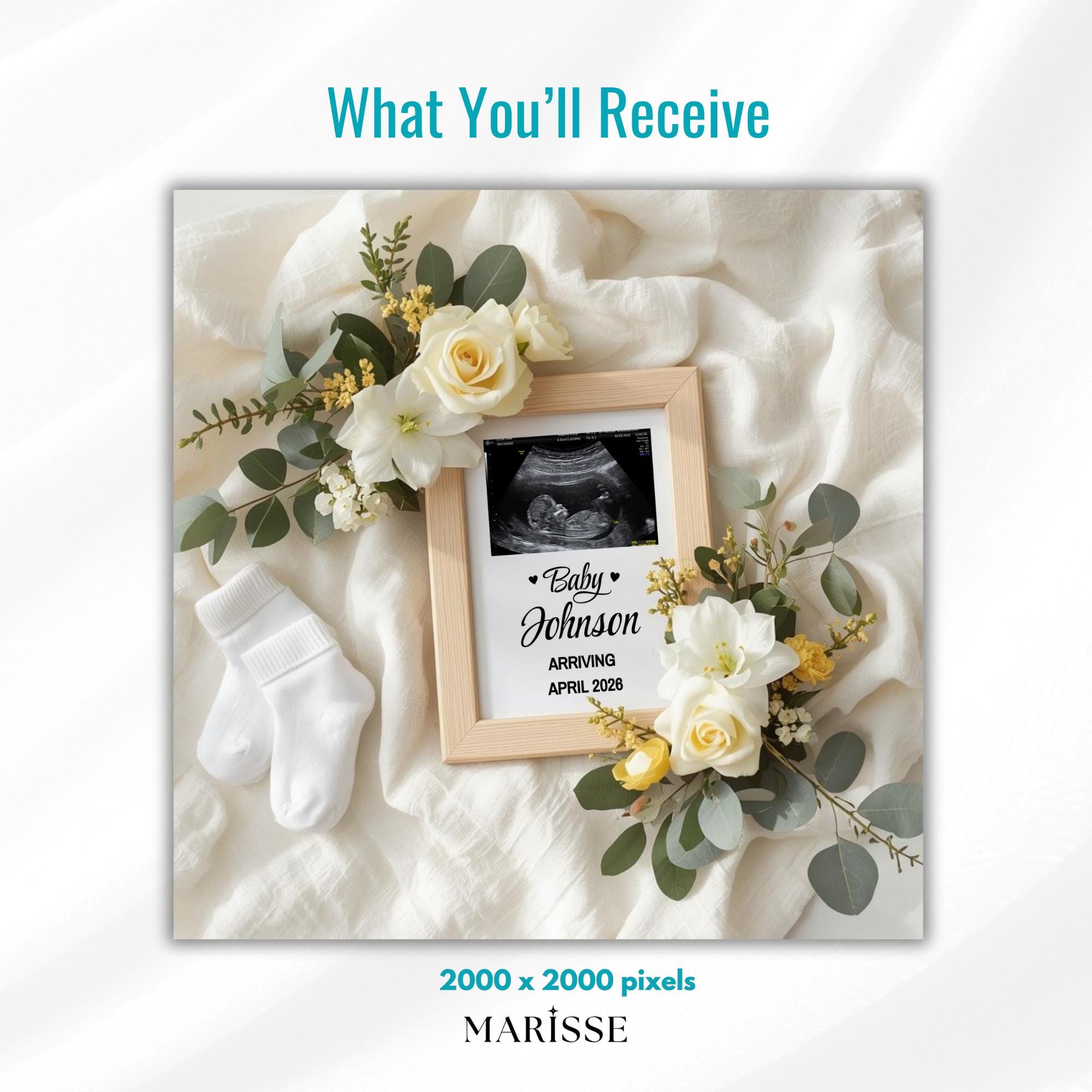 Yellow Floral Pregnancy Announcement Template | Baby Reveal Digital Download | Neutral Ultrasound Photo Prop | Baby Coming Soon